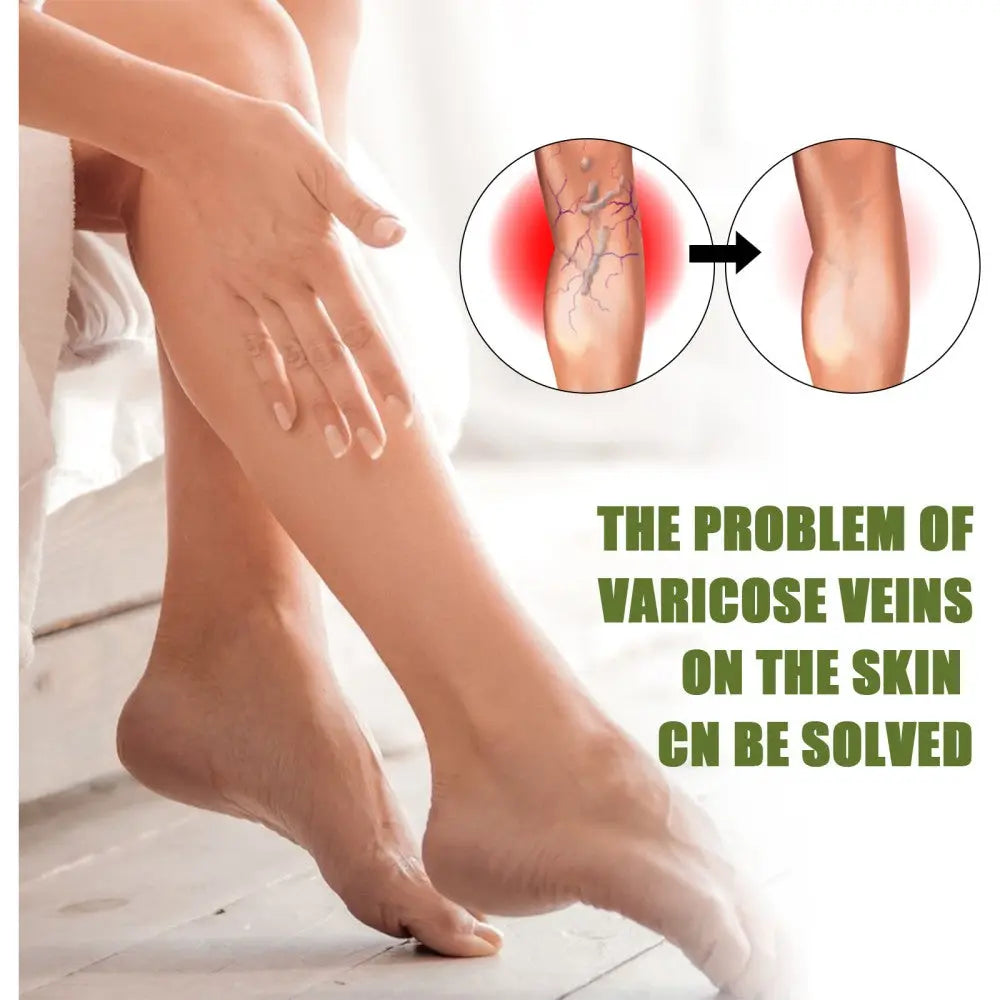 MEDix™ Varicose Veins Spray - EVERRD USA