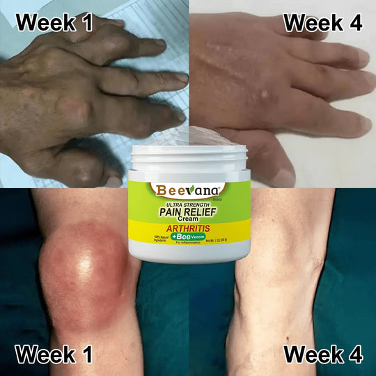 Beevana™ Bee Venom Joint & Bone Therapy Cream (Full Body Recovery, Pure Natural Formula) - EVERRD USA