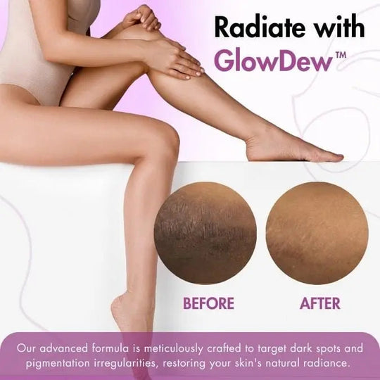 GlowDew™ Intimate Whitening Cream - EVERRD USA