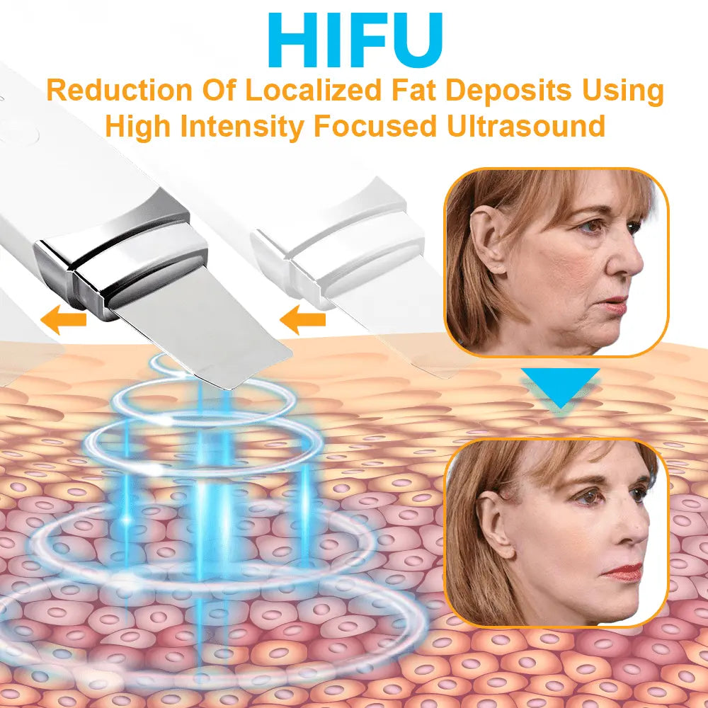 GFOUK™ HIFU Face Lifting Instrument - EVERRD USA