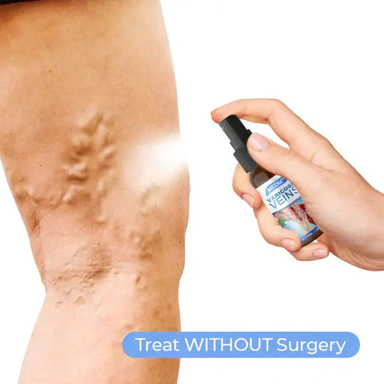 MEDix™ Varicose Veins Spray - EVERRD USA