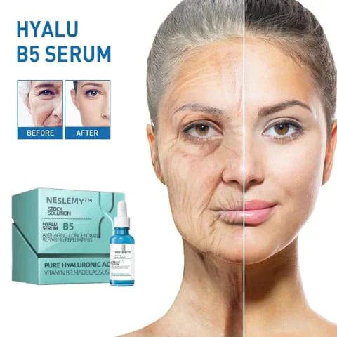 ⭐Last Day Promotion 70% OFF - 🔥Clostridium botulinum Face Serum - EVERRD USA