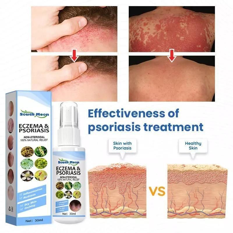 Herbal Psoriasis Relief Spray Everrd