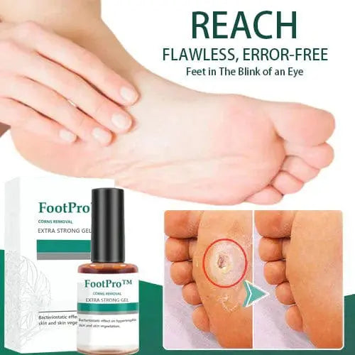 FootPro Corn Removal Extra Strengthen Gel - EVERRD USA