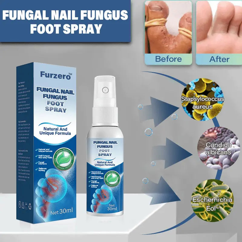 Furzero™ Medical grade fungal nail fungus foot spray - EVERRD USA