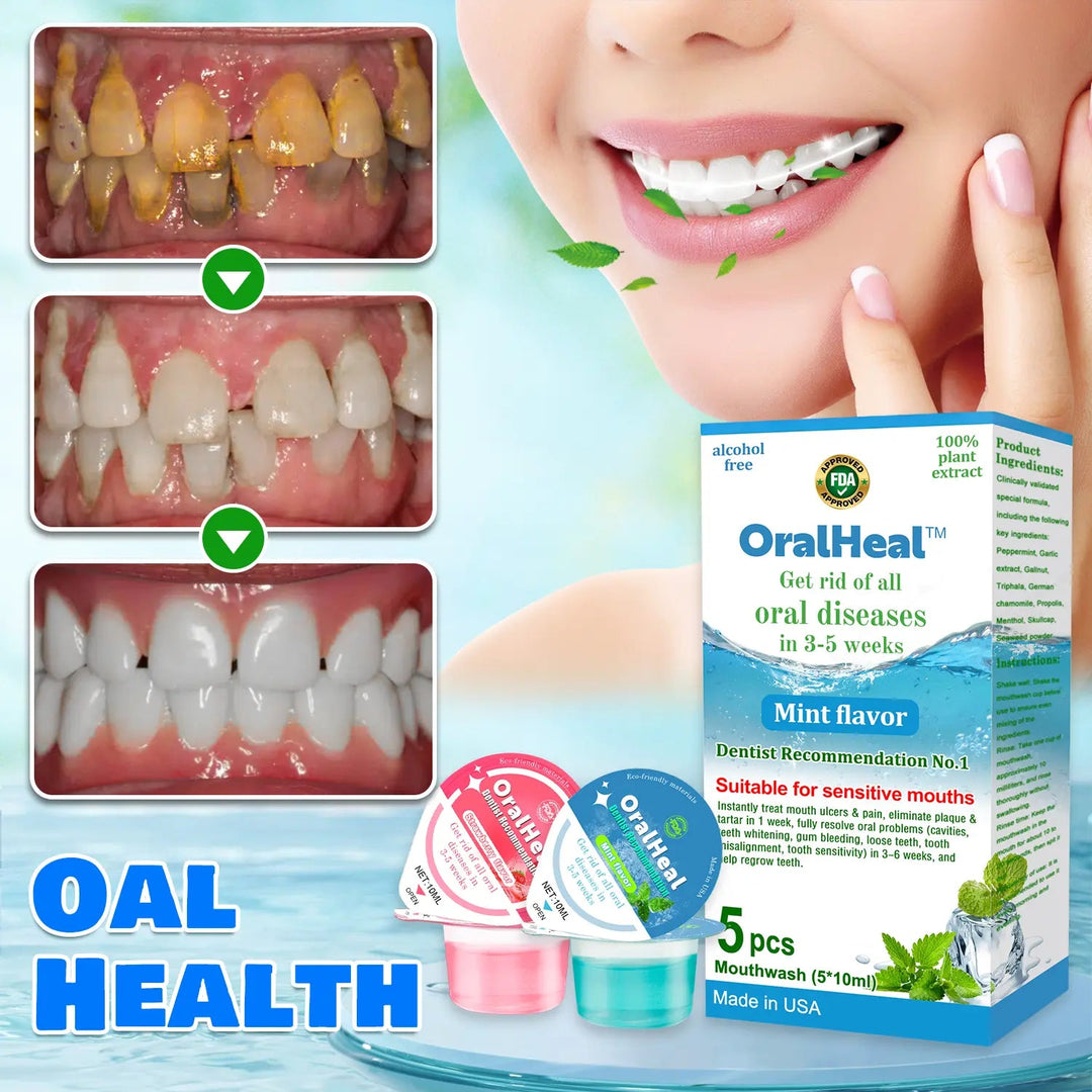 OralHeal™ Jelly Cup Mouthwash Restoring teeth and mouth to health⭐⭐⭐⭐⭐Limited time discount Last 30 minutes - EVERRD USA