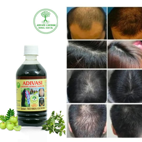 ADIVASI HERBAL NILAMBARI HAIR OIL! PACK OF 2 (BUY 1 GET 1 FREE)(4.9 ⭐⭐⭐⭐⭐ 93,830 REVIEWS) NEW Everrd