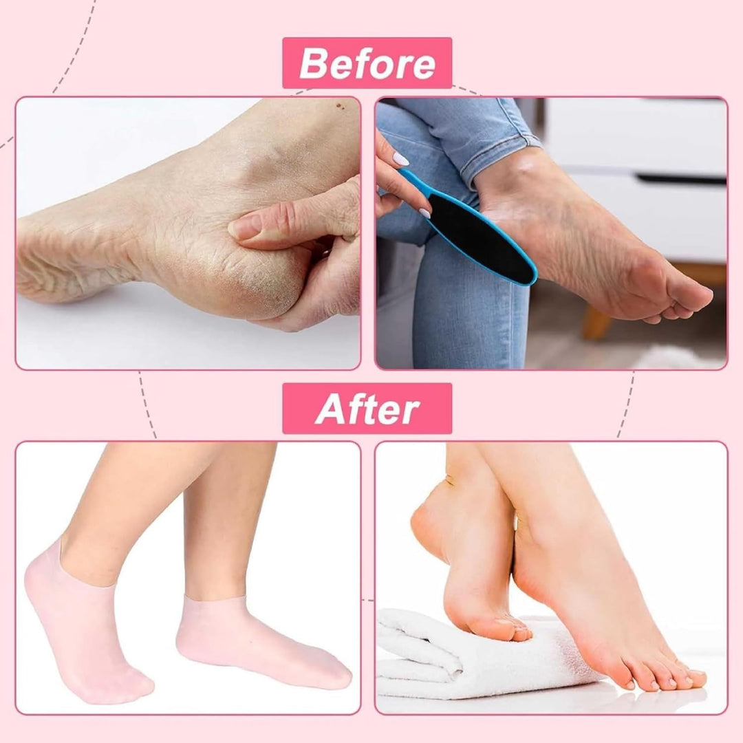 Silicone Moisturizing Socks (2 PAIR OF SOCKS) everrd