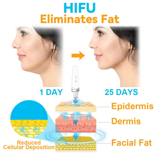 GFOUK™ HIFU Face Lifting Instrument - EVERRD USA