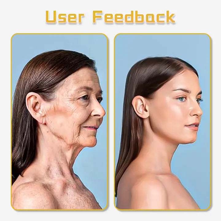 Biancat™ UltraRenew Ultrasonic Facelift Device - EVERRD USA