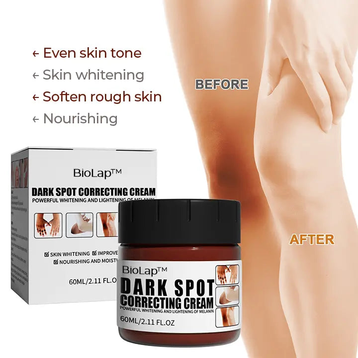 BioLap™ Dark Spot Correcting Cream - EVERRD USA