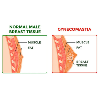 flysmus™ SoliPac Gynecomastia Tightening Herbal Cream - EVERRD USA