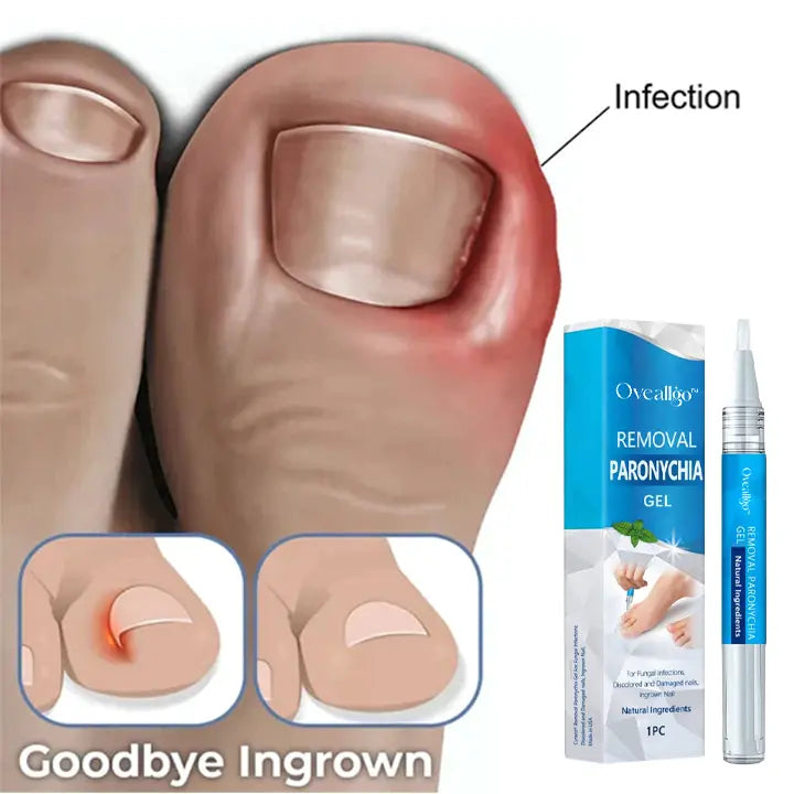 Oveallgo™ PRO Removal Paronychia Gel - EVERRD USA