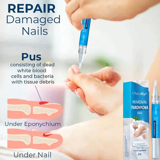 Oveallgo™ PRO Removal Paronychia Gel - EVERRD USA