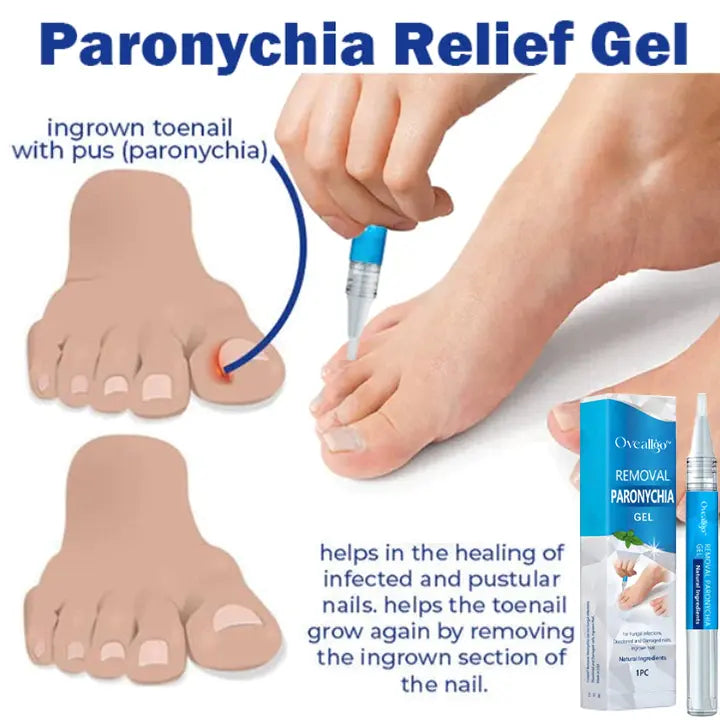 Oveallgo™ PRO Removal Paronychia Gel - EVERRD USA