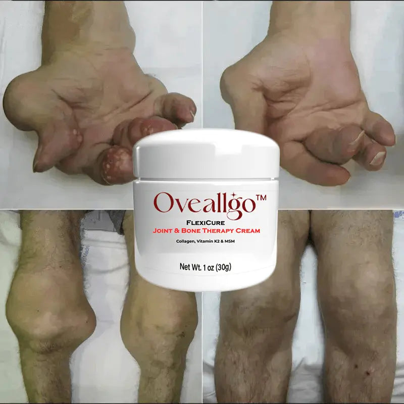 Oveallgo™ FlexiCure Joint & Bone Therapy Cream - EVERRD USA