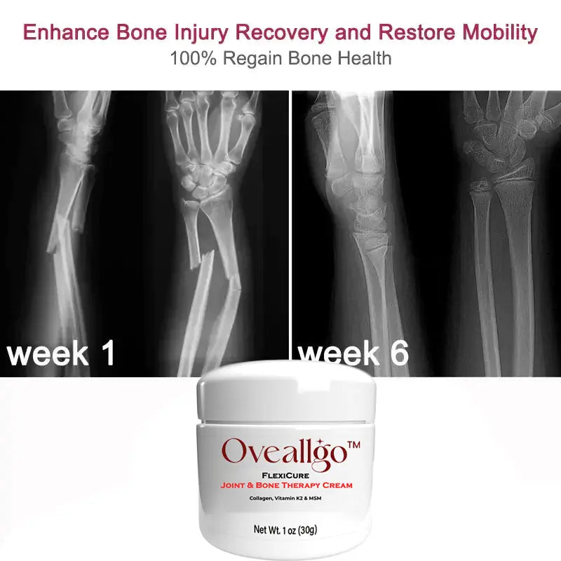 Oveallgo™ FlexiCure Joint & Bone Therapy Cream - EVERRD USA