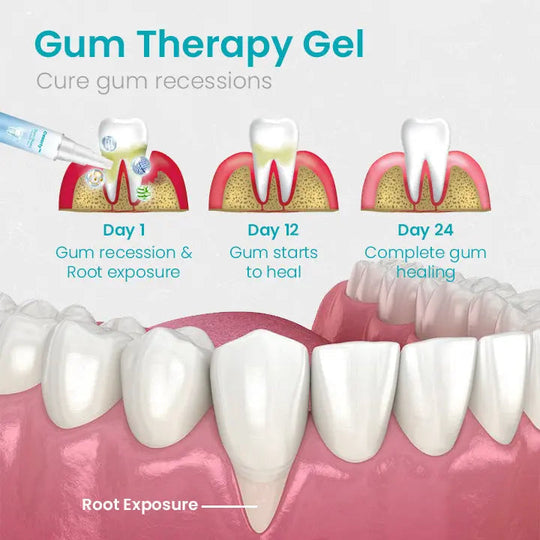 Ceoerty™ Gum Shield Therapy Gel - EVERRD USA