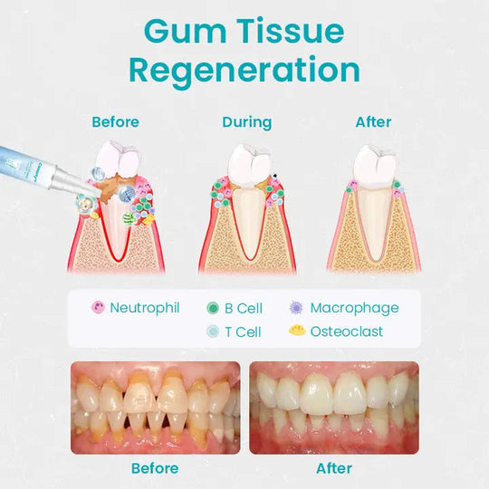 Ceoerty™ Gum Shield Therapy Gel - EVERRD USA