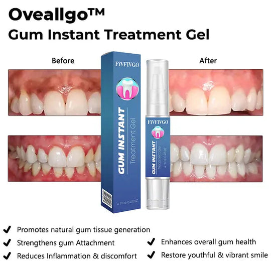 Oveallgo™ Gum Instant Treatment Gel - EVERRD USA