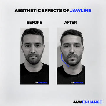 Jaw Enhance - Ultimate Facial Exerciser Everrd