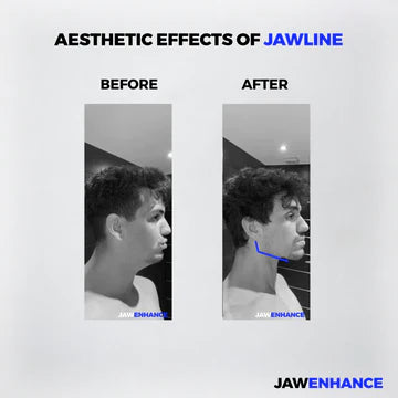 Jaw Enhance - Ultimate Facial Exerciser Everrd