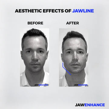 Jaw Enhance - Ultimate Facial Exerciser Everrd