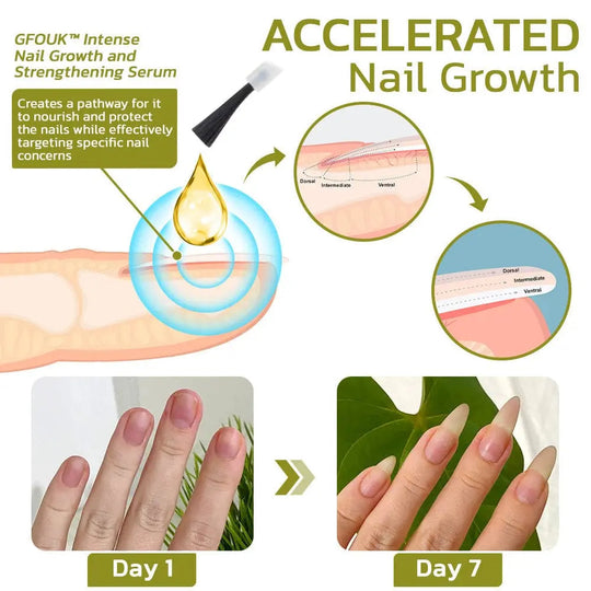 GFOUK™️ Intense Nail Growth and Strengthening Serum - EVERRD USA