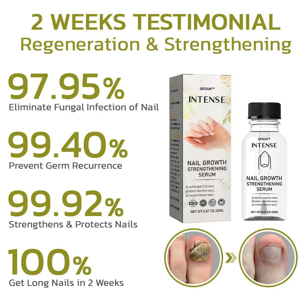 GFOUK™️ Intense Nail Growth and Strengthening Serum - EVERRD USA