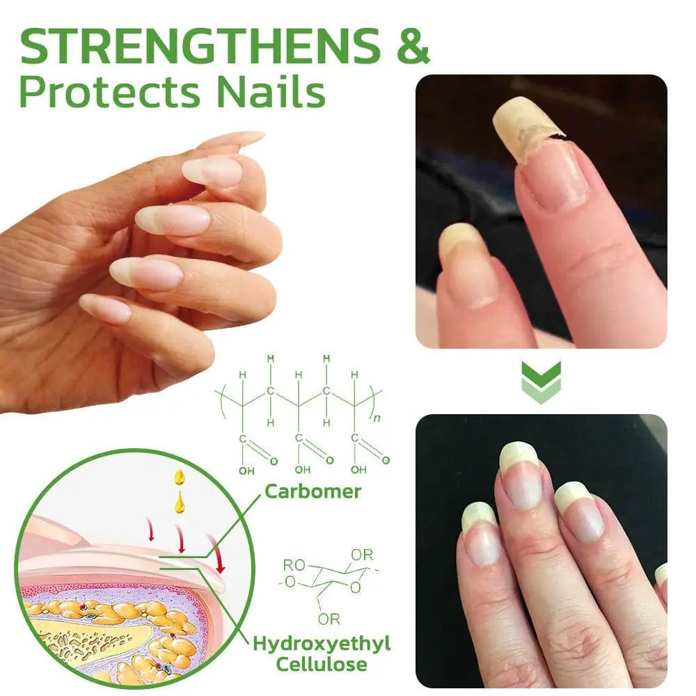 GFOUK™ 5 Days Nail Growth and Hardening Repair Roller - EVERRD USA