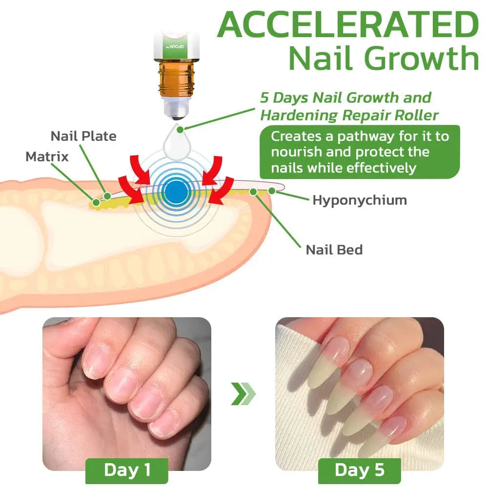 GFOUK™ 5 Days Nail Growth and Hardening Repair Roller - EVERRD USA