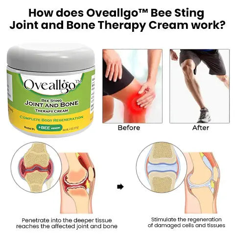 Oveallgo™ PRO Bee Sting Joint and Bone Therapy Cream - Complete Body Regeneration - EVERRD USA