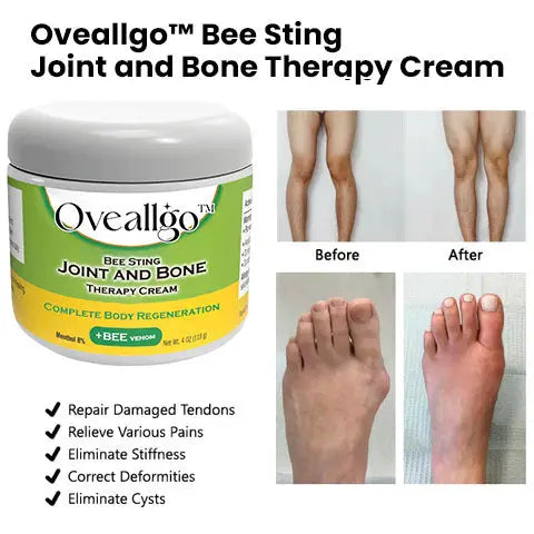 Oveallgo™ PRO Bee Sting Joint and Bone Therapy Cream - Complete Body Regeneration - EVERRD USA