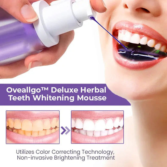 Oveallgo™ Deluxe Herbal Teeth Whitening Mousse - EVERRD USA