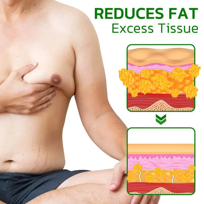 GFOUK™ TurmericMax Gynecomastia Compress Patch - EVERRD USA