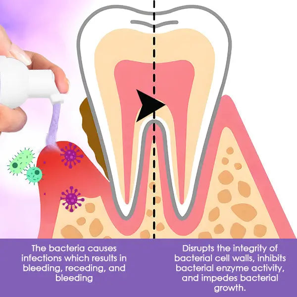 DentiCare™ Gum Treatment Foam - EVERRD USA