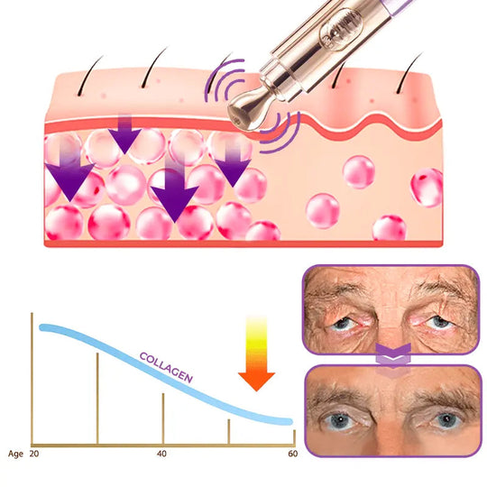 GFOUK™️ Milk Spots Therapy Electric Serum Pen - EVERRD USA