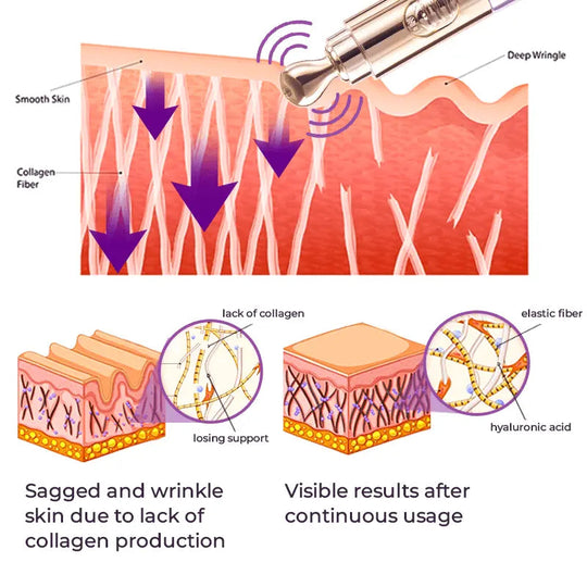 GFOUK™️ Milk Spots Therapy Electric Serum Pen - EVERRD USA