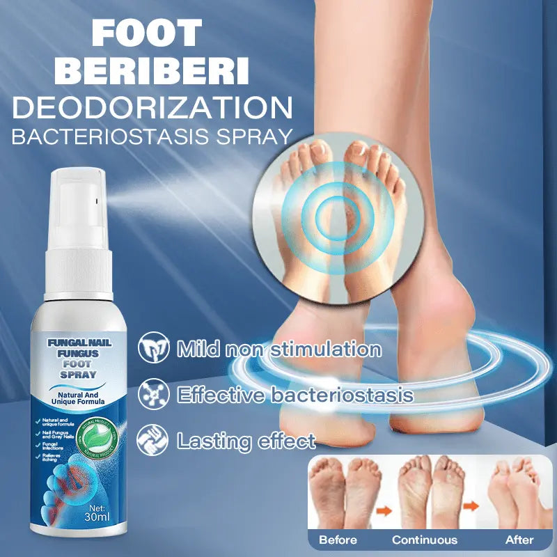 Furzero™ Medical grade fungal nail fungus foot spray - EVERRD USA